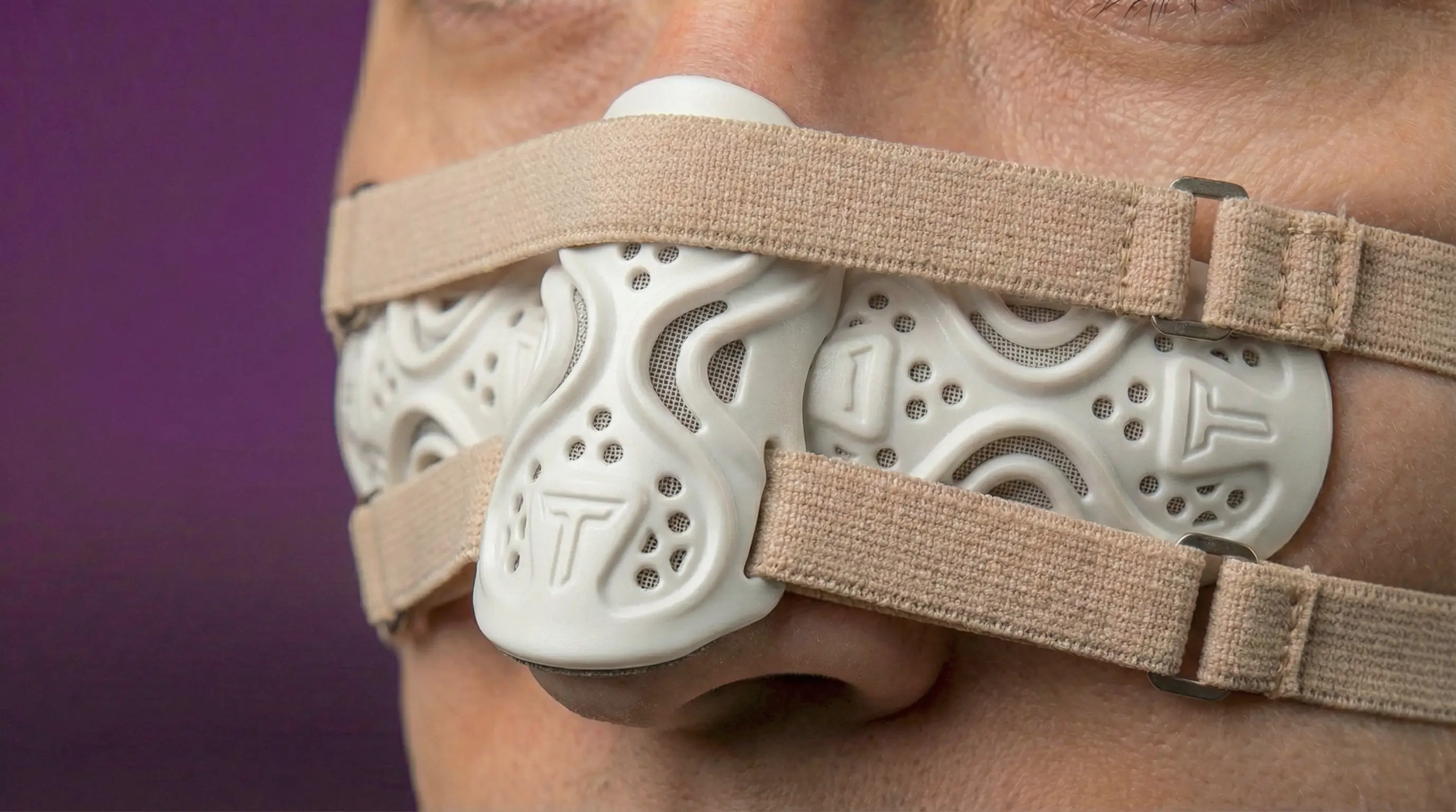 Férula impresa en 3D modelo Fortis para protección de tabique nasal